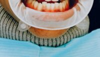 Common Dental Services You Should Know About