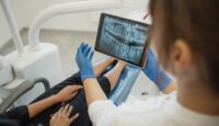 Why Tooth Extractions Are Needed