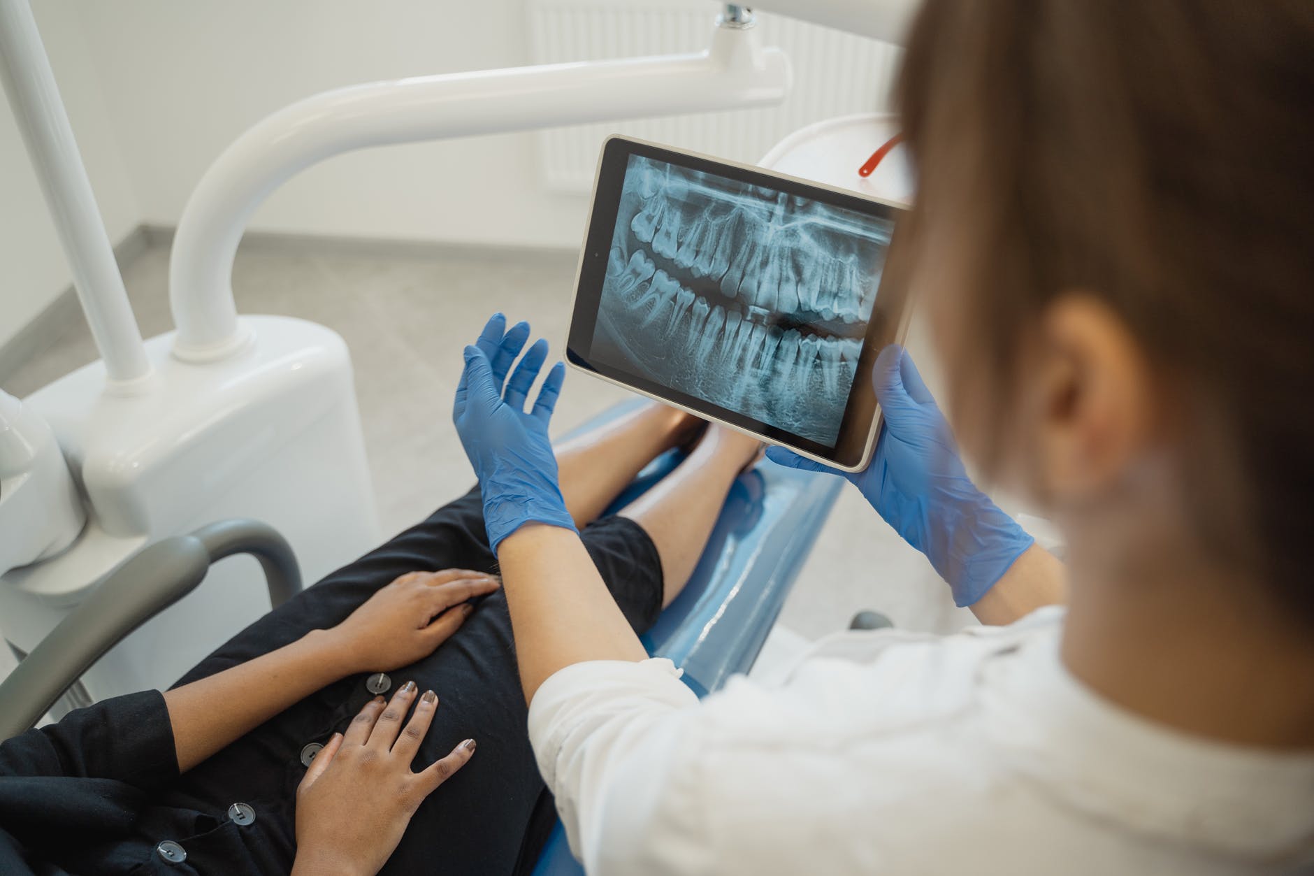 Why Tooth Extractions Are Needed