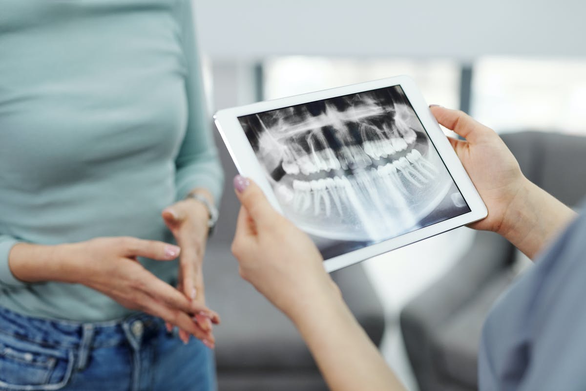 Dental Implant Care Tips You Should Know About