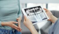 A Guide to Preparing for Dental Implant Surgery
